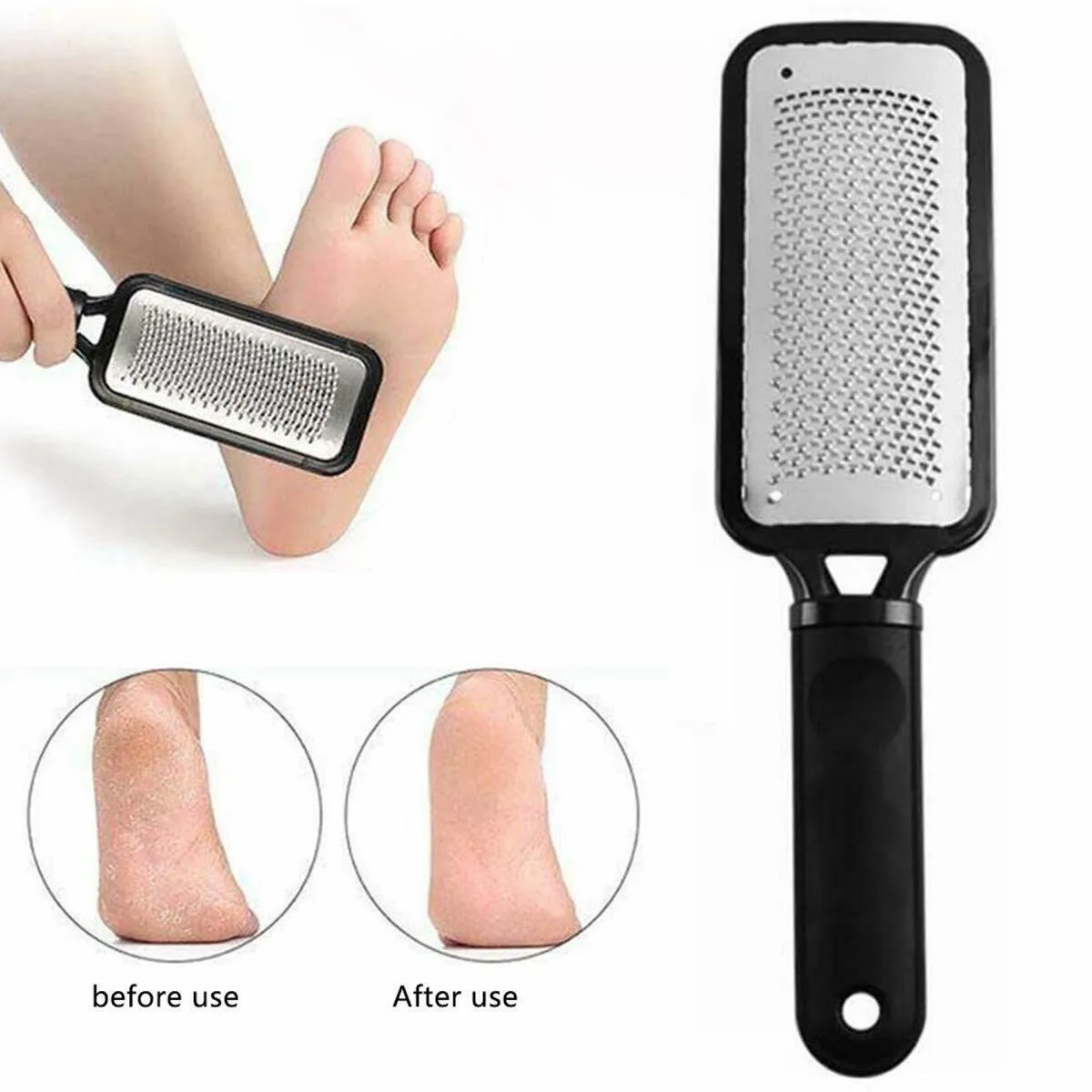 Foot Rasp File Callus Remover Pedicure Tool Dead Hard Skin Scraper Scrubber Tool